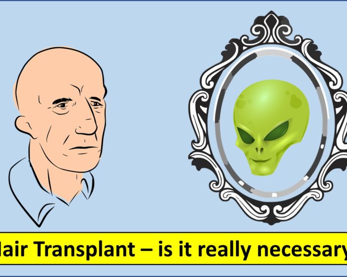 Hair Transplant - why it is necessary and how it helps you to become more attractive